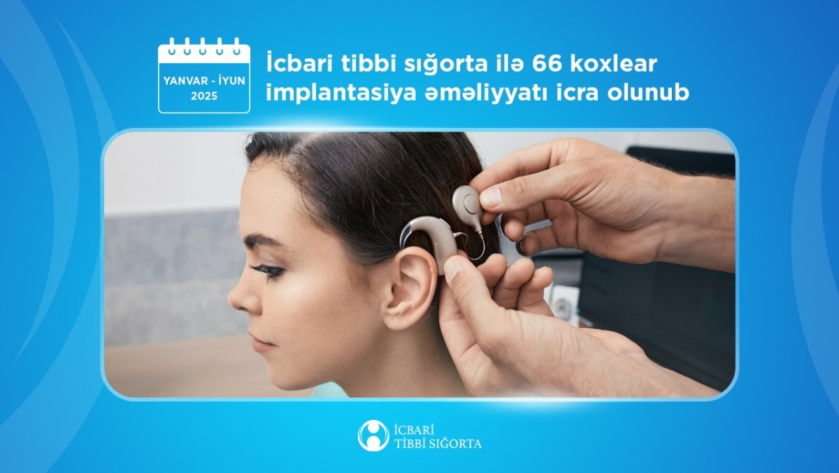 İcbari tibbi sığorta ilə 66 koxlear implantasiya əməliyyatı icra olunub