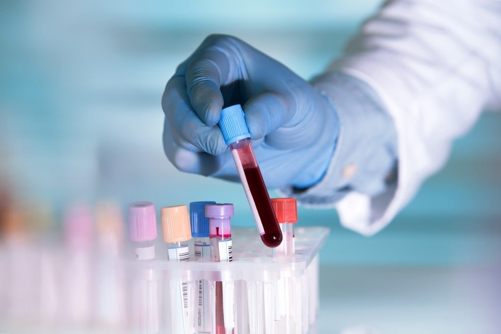 Yeni immunoterapiya xərçəngi tamamilə məhv edə bilər – Alimlərdən açıqlama