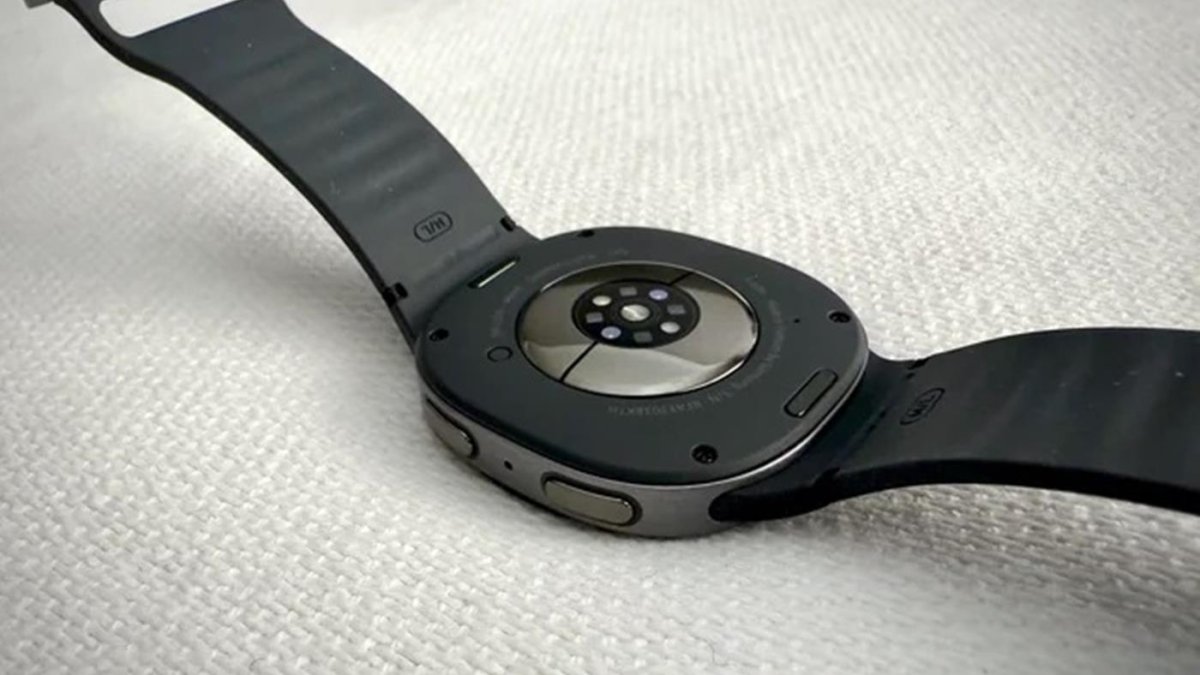 Galaxy Watch 8: İstifadəçi saatdan yanıq xəsarətləri aldığını iddia etdi