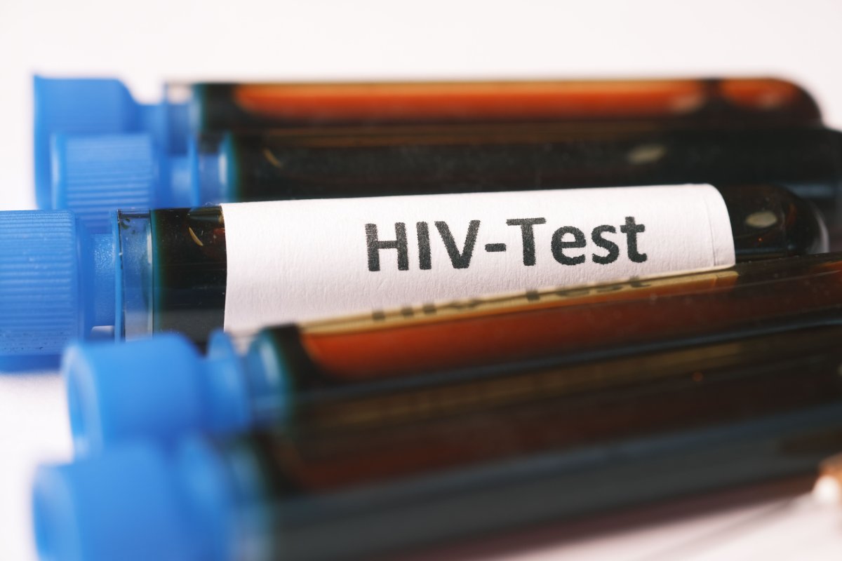 HIV-in tam müalicəsi tapıldı